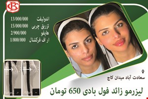 لیزر فول بادی فقط 650