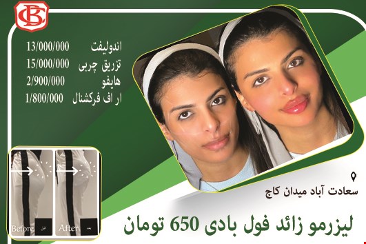 لیزر فول بادی فقط 650
