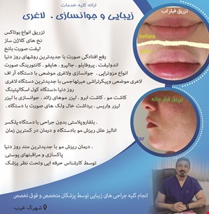 انجام کلیه جراحی های زیبایی توسط پزشکان متخصص و فوق تخصص در شهرک غرب 