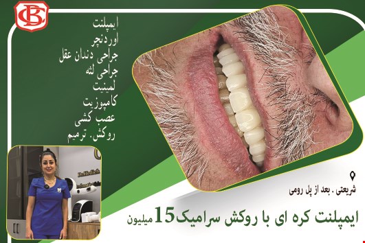 ایمپلنت. اوردنچر. جراحی دندان عقل